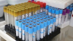 Проект по борьбе с гепатитом С стартует на Ставрополье